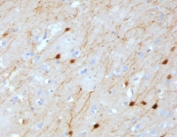 IHC testing of FFPE human cerebellum with Calretinin antibody (clone CLRT-1). HIER: boil tissue sections in pH6, 10mM citrate buffer, for 10-20 min followed by cooling at RT for 20 min.