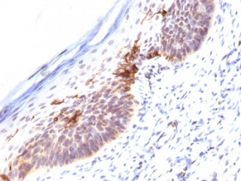 IHC staining of FFPE human skin with CD1a antibody (clone SPM120). HIER: boil tissue sections in pH 9 10mM Tris wi