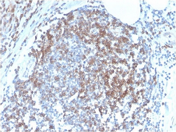IHC staining of FFPE human tonsil tissue with recombinant CD6 antibody (clone C6/2884R). HIER: boil tissue sections in pH6, 10mM citrate buffer, for 10-20 min followed by cooling at RT for 20 min.~