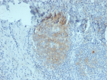 IHC staining of FFPE human tonsil tissue with CD80 antibody (clone C80/2776). HIER: boil tissue sections in 10mM Tris buffer with 1mM EDTA, pH 9, for 10-20 min and allow to cool before testing.~