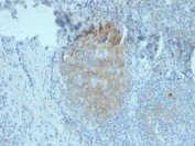 IHC staining of FFPE human tonsil tissue with CD80 antibody (clone C80/2776). HIER: boil tissue sections in 10mM Tris buffer with 1mM EDTA, pH 9, for 10-20 min and allow to cool before testing.