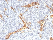 IHC testing of FFPE human tonsil with recombinant CD34 antibody (clone HPCA1/2598R). Required HIER: boil tissue sections in 10mM Tris with 1mM EDTA, pH 9, for 10-20 min followed by cooling at RT for 20 min.