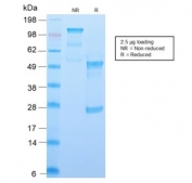 SDS-PAGE analysis of purified, BSA-free recombinant CD34 antibody (clone HPCA1/2598R) as confirmation of integrity and purity.