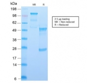 SDS-PAGE analysis of purified, BSA-free recombinant CD34 antibody (clone HPCA1/2598R) as confirmation of integrity and purity.