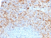 IHC testing of FFPE human spleen with CD40 Ligand antibody (clone CD40LG/2761). HIER: boil tissue sections in pH6, 10mM citrate buffer, for 10-20 min followed by cooling at RT for 20 min.