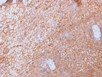 IHC testing of FFPE human spleen with CD40 Ligand antibody (clone CD40LG/2761). HIER: boil tissue sections in pH6, 10mM citrate buffer, for 10-20 min followed by cooling at RT for 20 min.~