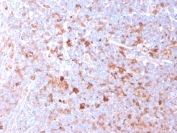 IHC testing of FFPE human tonsil with CD40 Ligand antibody (clone CD40LG/2761). HIER: boil tissue sections in pH6, 10mM citrate buffer, for 10-20 min followed by cooling at RT for 20 min.