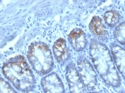IHC testing of FFPE human colon with CD40 Ligand antibody (clone CD40LG/2761). HIER: boil tissue sections in pH 9 10mM Tris with 1mM EDTA for 20 min and allow to cool before testing.