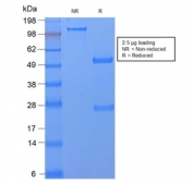 SDS-PAGE analysis of purified, BSA-free recombinant CD59 antibody (clone MACIF/2867R) as confirmation of integrity and purity.
