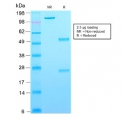 SDS-PAGE analysis of purified, BSA-free recombinant CD63 antibody (clone rMX-49.129.5) as confirmation of integrity and purity.