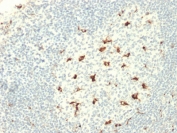 IHC staining of FFPE human tonsil with CD68 antibody (clone C68/2709). HIER: boil tissue sections in pH6 10mM citrate buffer, or pH 9 10mM Tris with 1mM EDTA, for 10-20 min followed by cooling at RT for 20 min.