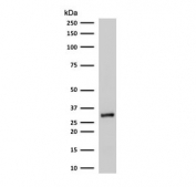 Western blot testing of human A375 cell lysate with RPA32 antibody. Expected molecular weight ~32 kDa.