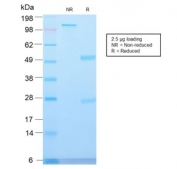 SDS-PAGE analysis of purified, BSA-free recombinant MVP antibody (clone VP2897R) as confirmation of integrity and purity.