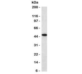 Western blot testing of human HCT116 antibody with recombinant Keratin 18 antibody (clone CTKN18-2R). Predicted molecular weight ~48 kDa.~