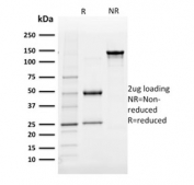 SDS-PAGE analysis of purified, BSA-free Aldose reductase antibody (clone CPTC-AKR1B1-3) as confirmation of integrity and purity.