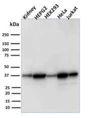 Aldose Reductase Antibody Multi-Sample WB. Western blot analysis of human kidney tissue and human HepG2, HEK293, HeLa, and Jurkat cell lysates using Aldose Reductase Antibody clone CPTC-AKR1B1-3. A predominant band is detected near approximately 35-40 kDa across multiple samples, consistent with the expected molecular weight range of Aldose reductase / AKR1B1, a cytoplasmic aldo-keto reductase family enzyme involved in polyol pathway metabolism, glucose-responsive signaling, and oxidative stress-associated cellular regulatory mechanisms.