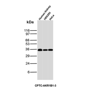 Aldose Reductase Antibody Tissue and Cell Line WB. Western blot analysis of human kidney tissue together with HEK293 and HeLa cell lysates using Aldose reductase Antibody clone CPTC-AKR1B1-3. A strong band is detected near approximately 35-40 kDa across all samples, consistent with the expected molecular weight range of Aldose reductase / AKR1B1, a cytoplasmic aldo-keto reductase family enzyme involved in polyol pathway metabolism, oxidative stress regulation, and glucose-responsive cellular signaling pathways.