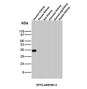 Aldose Reductase Antibody Cross-Species WB. Western blot analysis of human, mouse, rat, hamster, guinea pig, and rabbit kidney tissue lysates using Aldose reductase Antibody clone CPTC-AKR1B1-3. A distinct band is detected near approximately 35-40 kDa in human kidney tissue, consistent with the expected molecular weight range of Aldose reductase / AKR1B1, a polyol pathway-associated metabolic enzyme involved in glucose metabolism and oxidative stress-responsive cellular regulation. Minimal signal is observed in the additional species tested under these experimental conditions.