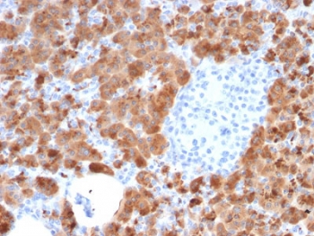 IHC testing of FFPE human pancreas with Carboxypeptidase A1 antibody (clone CPA1/2714). HIER: boil tissue sections in pH6, 10mM citrate buffer, for 10-20 min followed by cooling at RT for 20 min.~