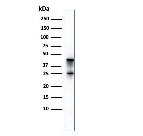 Western blot testing of human pancreas lysate with Carboxypeptidase A1 antibody (clone CPA1/2714). Predicted molecular weight ~47 kDa.
