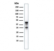 Western blot testing of human pancreas lysate with Carboxypeptidase A1 antibody (clone CPA1/2714). Predicted molecular weight ~47 kDa.
