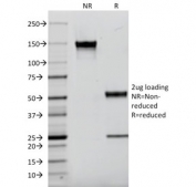 SDS-PAGE analysis of purified, BSA-free EGF Receptor antibody (clone F4) as confirmation of integrity and purity.