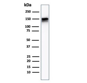 Western blot testing of human A431 cell lysate with EGF Receptor antibody (clone F4). Expected molecular weight: 134-180 kDa depending on glycosylation level.~