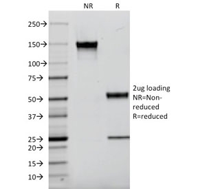 SDS-PAGE analysis of purified, BSA-free EGF Receptor antibody (clone F4) as c