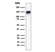Western blot testing of human A431 cell lysate with EGF Receptor antibody (clone F4). Expected molecular weight: 134-180 kDa depending on glycosylation level.