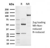 SDS-PAGE analysis of purified, BSA-free recombinant Elastin antibody (clone ELN/3131R) as confirmation of integrity and purity.