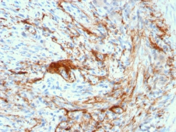 IHC testing of FFPE human small intestine with recombinant Elastin antibody (clone ELN/3131R). Required HIER: boiling tissue sections in 10mM citrate buffer, pH 6, for 10-20 min and allow to cool prior to staining.~