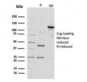 SDS-PAGE analysis of purified, BSA-free HER2 antibody (clone ERBB2/3092) as confirmation of integrity and purity.