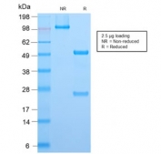 SDS-PAGE analysis of purified, BSA-free recombinant ALK antibody (clone ALK1/2766R) as confirmation of integrity and purity.