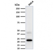 Western blot testing of human HeLa cell lysate with FTL antibody (clone FTL/1387). Predicted molecular weight ~20 kDa.