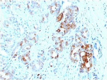 IHC testing of FFPE human prostate with FTL antibody. Required HIER: boil tissue sections in 10mM citrate buffer, pH 6, for 10-20 min and allow to cool before testing.~