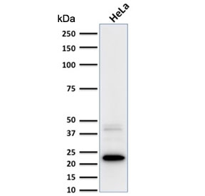 Western blot testing of human HeLa cell lysate with FTL antibody. Pr