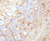 IHC staining of FFPE human cerebellum with recombinant NF-H antibody (clone NFHP-1R). Required HIER: boil tissue sections in 10mM citrate buffer, pH6, for 10-20 min and allow to cool before testing.