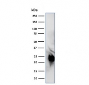 Western blot testing of human HeLa cell lysate with GLO1 antibody. Predicted molecular weight ~21 kDa.