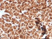 IHC testing of FFPE human pancreas with recombinant GP2 antibody (clone GP2/3134R). HIER: boil tissue sections in pH 9 10mM Tris with 1mM EDTA for 10-20 min and allow to cool before testing.