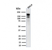Western blot testing of human HeLa lysate with MSH6 antibody. Expected molecular weight: 120-160 kDa depending on phosphorylation level.