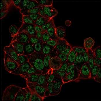 Immunofluorescent staining of permeabilized human MCF7 cells with MSH6 antibody (green, clone MSH6/3085) and Phalloidin (red).