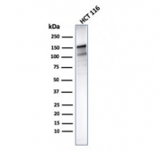 Western blot testing of human HCT-116 lysate with MSH6 antibody (clone MSH6/3085). Predicted molecular weight ~160 kDa.