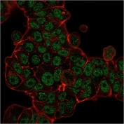 Immunofluorescent staining of permeabilized human MCF7 cells with MSH6 antibody (green, clone MSH6/3085) and Phalloidin (red).