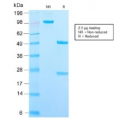 SDS-PAGE analysis of purified, BSA-free recombinant DC-SIGN antibody (clone C209/2749R) as confirmation of integrity and purity.