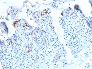IHC staining of FFPE human small intestine with recombinant DC-SIGN antibody (clone C209/2749R). HIER: boil tissue sections in 10mM Tris with 1mM EDTA, pH 9, for 10-20 min followed by cooling at RT for 20 min.~