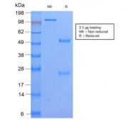 SDS-PAGE analysis of purified, BSA-free recombinant HLA-DPB1 antibody (clone HLA-DPB1/2862R) as confirmation of integrity and purity.
