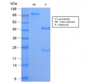 SDS-PAGE analysis of purified, BSA-free recombinant HLA-DQ antibody (clone HLA-DQA1/2866R) as confirmation of integrity and purity.