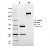 SDS-PAGE analysis of purified, BSA-free HLA-DR antibody (clone TAL 1B5) as confirmation of integrity and purity.