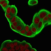 Immunofluorescent staining of PFA-fixed human MCF7 cells with HSP27 antibody (clone CPTC-HSPB1-2, green) and Reddot nuclear stain (red).