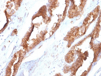 IHC staining of FFPE human prostate tissue with HSP27 antibody (clone CPTC-HSPB1-2). HIER: boil tissue sections in pH 9 10mM Tris with 1mM EDTA for 10-20 min and allow to cool before testing.~